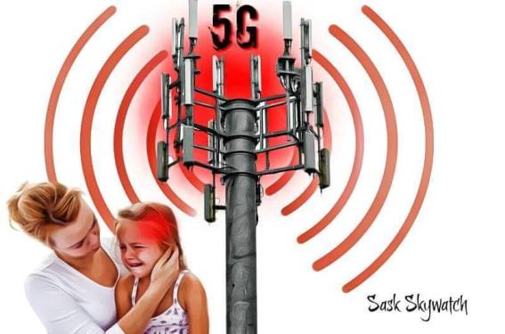 5g (1)