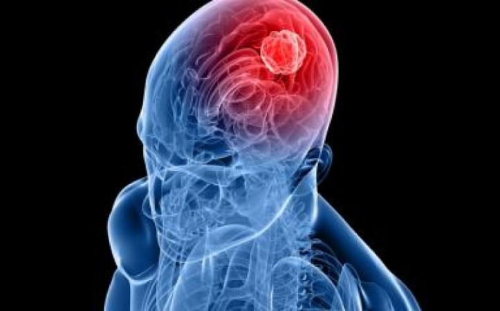 mezzora-di-cellulare-al-giorno-raddoppia-il-rischio-di-tumore-al-cervello-tumore_cervello_cancro_salute_telefonino_cellulare-800x500_c[1]